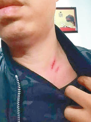 胡男被強行押走做結紮手術，反抗時遭毆打。（互聯網圖片）