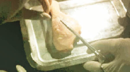學員用導師派發的雞髀練割雙眼皮。（互聯網圖片）