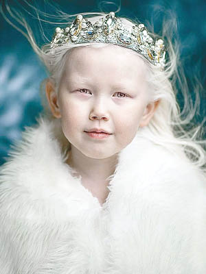 納里亞娜因病擁有一頭白髮及白色的肌膚。（互聯網圖片）