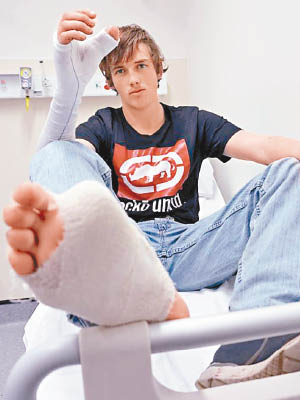 米切爾右手拇指斷掉，醫生將他的右腳趾公切下接駁補救。（互聯網圖片）