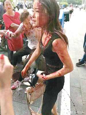 女傷者臉部鮮血淋漓。（互聯網圖片）