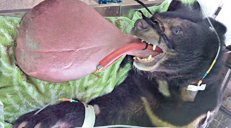 光明的舌頭異常腫脹，需接受手術切除。（互聯網圖片）