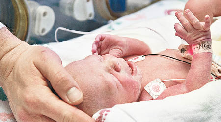 全美首位從移植子宮誕生的嬰兒在德州出生。（美聯社圖片）