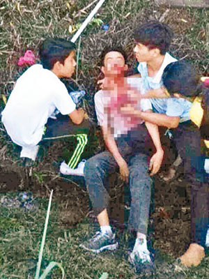華裔男生被打至血流披面。（互聯網圖片）
