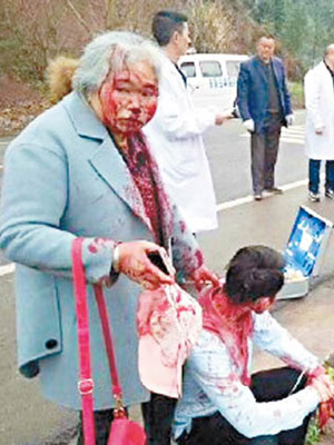 四川<br>一名婦人與一名男子血流披面，在路邊等待救援。（互聯網圖片）