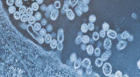 專家指H7N9有可能變成人傳人。（美聯社圖片）