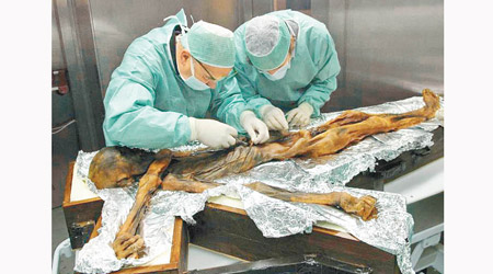科學家抽取冰人奧茨的胃部組織。（互聯網圖片）