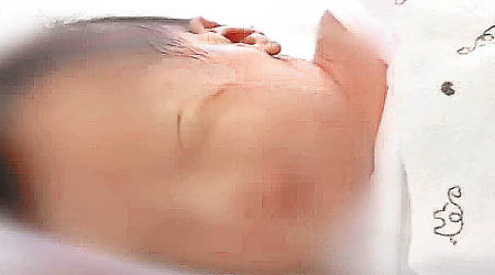 嬰兒的左臉頰留有刀痕。（電視畫面）
