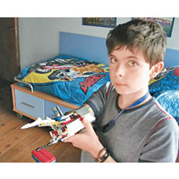 阿古拿童年時已開始設計機械義肢。（互聯網圖片）
