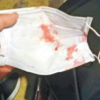 女學生被打至流鼻血。（互聯網圖片）