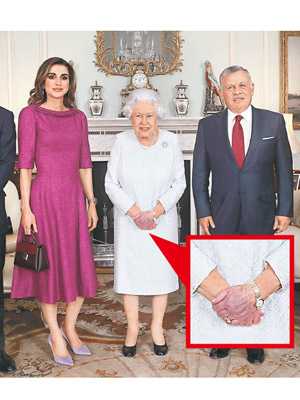 英女王（中）的左手手背瘀了一大片。（美聯社圖片）