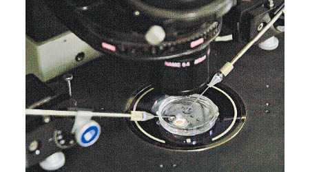 賀建奎團隊當時透過向胚胎注射，修改基因。（美聯社圖片）