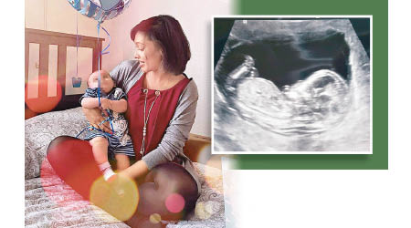 福賴萊早前抱着姪兒合照（圖左），而剛懷孕時，福賴萊曾在社交網貼出胎兒超聲波圖片（圖右）。（互聯網圖片）