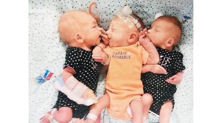 三胞胎順利出生。