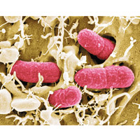 有腸鏡仍殘留大腸桿菌等致病微生物。