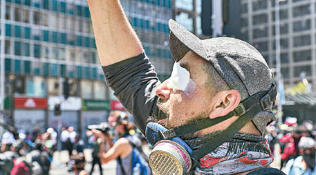 智利警方被指開槍射爆示威者的眼睛。