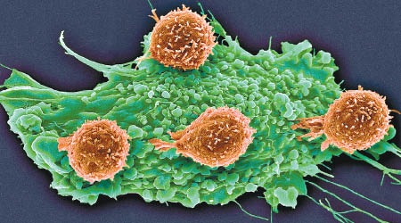 研究人員改變病人巨噬細胞的基因，令它可以攻擊癌細胞。