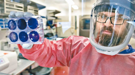 美國匹茲堡大學研究人員展示新冠病毒的樣本。