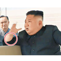 疑似傷口：專家指金正恩右手手腕有傷口。