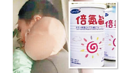 有嬰兒進食問題奶粉（右圖）後，出現頭變大的徵狀。