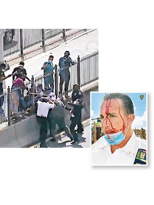 上圖：紐約多名警員遇襲。右圖：警員頭破血流。