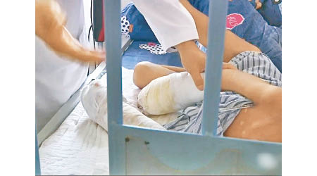 男童手部嚴重受傷，在醫院接受醫生治療。