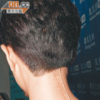 鄭希怡頸背位五吋長疤痕清晰可見。
