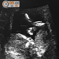 關穎報喜懷孕3個月，醫生初步估計是女兒。