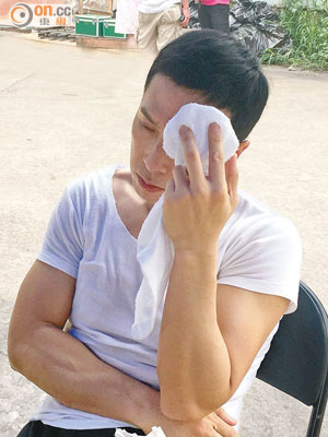 拍戲受傷的甄子丹用毛巾按着額頭。