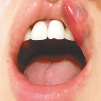 郭思琳上載「戰績」嘴唇慘被打至紅腫。