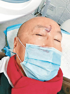 張之珏在酒店發生意外，但拒絕入院。