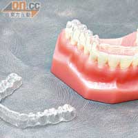 最新的隱形牙箍技術會按照病人的牙齒訂製牙箍，配合透明設計，佩戴後不易察覺。