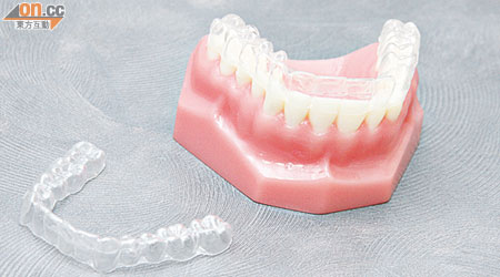 「隱形牙箍」對前排牙齒輕度不整齊的人士尤其適合。