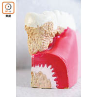 誰不想口腔健康？圖中模型展示牙菌膜積藏情況。