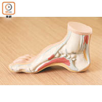 高弓足：由於足弓位置較高，前腳掌和足跟受壓特別嚴重，需要特別吸震的鞋墊，才能紓緩壓力。