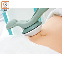 如出現色斑或妊娠紋，可於產後3至6個月接受激光療程。