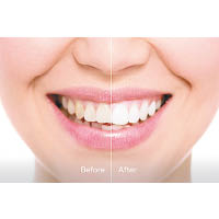 使用3星期後的效果，牙齒的潔淨程度有顯著分別。