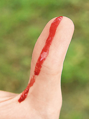 https://upload.wikimedia.org/wikipedia/commons/8/87/Bleeding_wound_on_thumb.jpg