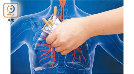 吸煙會引起肺癌等致命疾病，煙民的死亡率比常人高出1至3倍，所以愈早戒煙愈好！