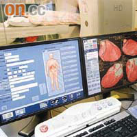 養和醫院引入高清電腦掃描器，更準確診斷心血管斑塊。	（羅錦鴻攝）