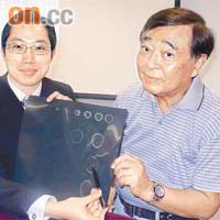 梁裕龍（左）指殷先生的腦部掃描結果顯示微絲血管梗死，與其患青光眼有關。