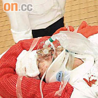 四十四歲媳婦魏秀蓮當日被劈傷頭後，血流披臉送院。