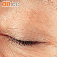 使用後<br>有表現較佳的眼霜，試用者使用後眼尾位置的皺紋長度縮短。