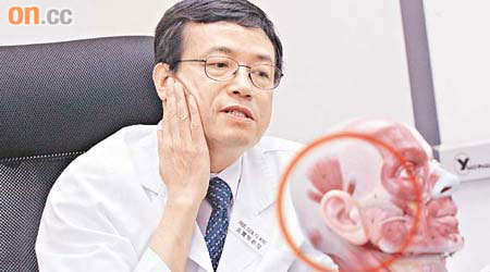袁寶榮指，腮腺瘤患者可憑手觸摸到臉側耳前皮下位置腫起（圓圈示）。