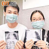 茵茵父母手持台北榮民總醫院治愈同類嬰兒病人的Ｘ光片。	（鍾麗珊攝）