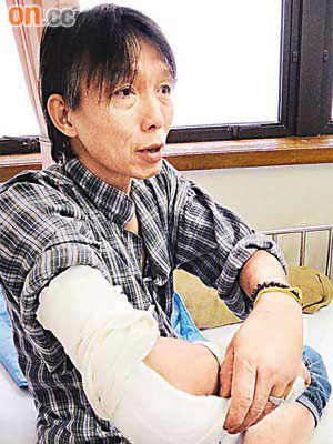 梁先生的右手幸及時接受手術並植入金屬托，否則恐有殘障之虞。