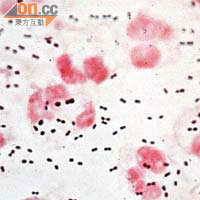 肺炎球菌專攻幼童，冬天更是病發高峰期。