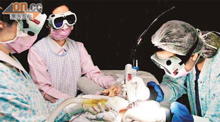 醫護人員利用激光為兒童清除胎痣。
