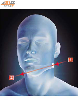 謝廷駿<BR>子彈由左頸上方（1）進入切斷多條血管後由右頸（2）穿出。