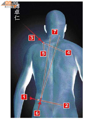 中三槍，首槍左腹進入（1）卡在右臀肌肉（2）；次槍背部進入（3）撞肋骨後分為二，分別停在前胸椎骨（4）及左胸肌肉（5）；第三槍下背射入（6） 撞上肋骨碎裂，四散割破心臟、大動脈及肺部，卡在頸椎前方（7）。